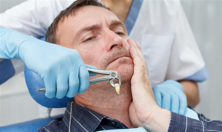 Wisdom tooth removal in Gurgaon at Muskaan Dentals — painless surgical and simple extraction by Dr. Suresh Ahlawat