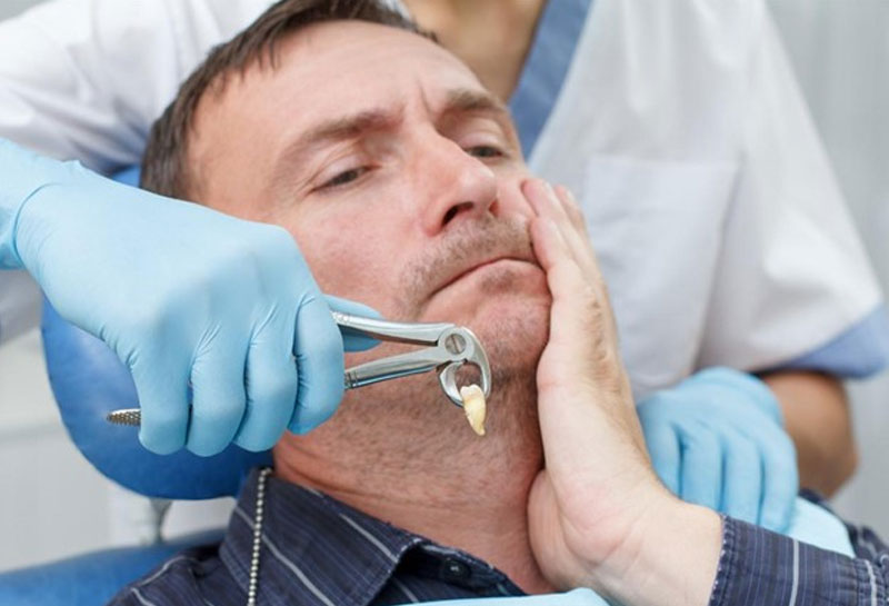 Wisdom tooth removal in Gurgaon at Muskaan Dentals