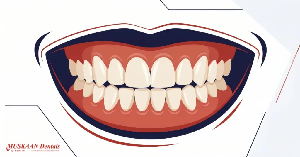 All-on-4 same-day fixed teeth result Gurgaon — Muskaan Dentals